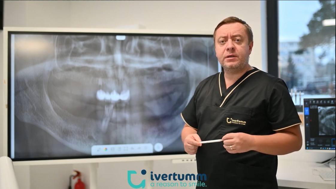 Ivertumm